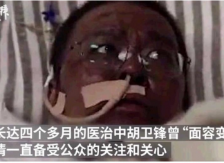 李文亮同事胡衛鋒染疫逝世