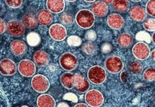 中國提高猴痘預警級別 按照B類方案進行管理